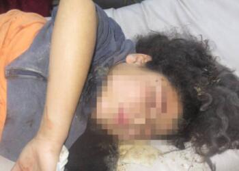 Zarokek di êrişa Tirkiyeyê de jiyana xwe ji dest da