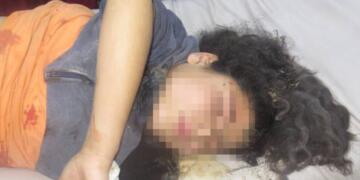 Zarokek di êrişa Tirkiyeyê de jiyana xwe ji dest da