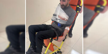 Polîsan milê endamê DBPê Kenan Îldenîz şikand