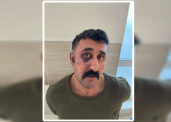 Polîsan hem îşkence lê kirin û hem jî xwestin sûcê xwe binixumînin