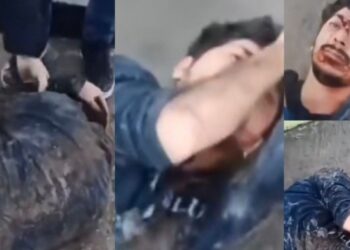  Rewşa weşîya Dîyar Koçî giran a