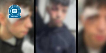 Îşkenceya polîsan: Lêdan û gotin ji derenceyê ketiye