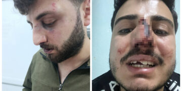 Li Wanê hovîtiya polîsan: Bi îşkenceyê poz û diranên ciwanekê şikandin