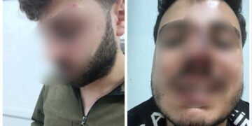 Li Wanê hovîtiya polîsan: Bi îşkenceyê poz û diranên ciwanekê şikandin